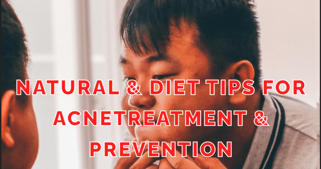 Natural & Diet Tips for AcneTreatment & Prevention